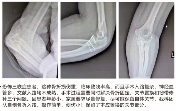 杭州富春中医骨伤医院 (3).jpg 杭州富春中医骨伤医院 (3).jpg